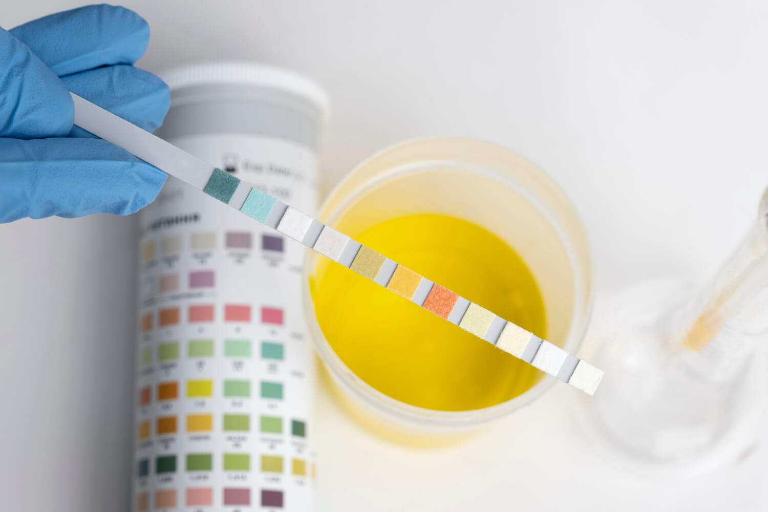 The Usage and Arrangement of the Artificial Urine Kits 